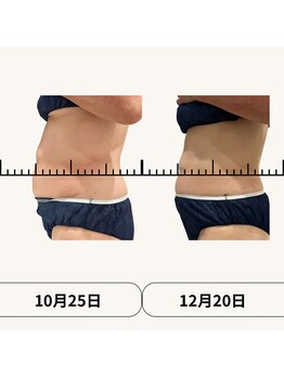 ボディトーン(bodytone)/目指すは代謝の良い体!