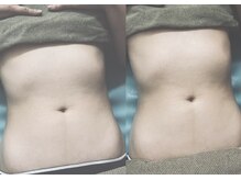 クリスタルプュリティ(Crystal Purity)の雰囲気(わずか10分。クリスタルドレナージュ)