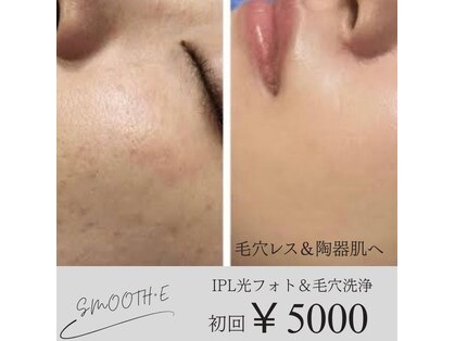 スムース イー(Smooth+E)の写真