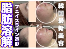 アンドユー(&u)