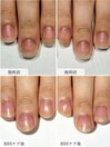 縦長美爪育成ケア/ハンドケア