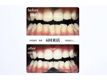 ヌールホワイト 御徒町店(NOOR WHITE)の雰囲気（歯科提携サロンなので効果がわかりやすい◎駅近×個室♪）