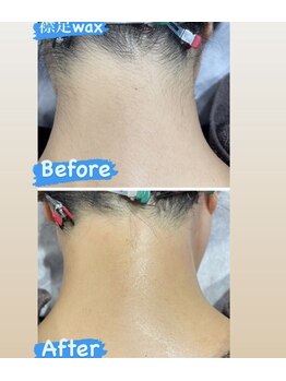 ビューティー アディクト(Beauty addict)/夏に向けて♪襟足ワックス