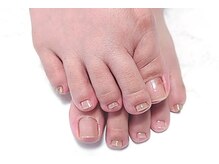 ノーブルフルール(Noble fleur)/フット★自爪を健康に導くケア