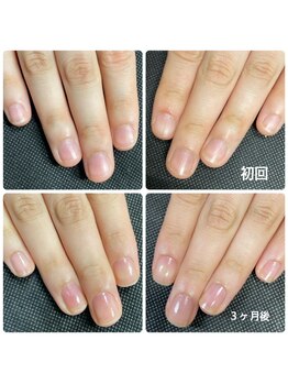 カラーネイルスタジオ(Callanail studio)/更に美爪へ♪