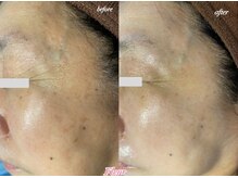 フルール(Fleur)/◆年齢不詳の美肌/目元美容◆