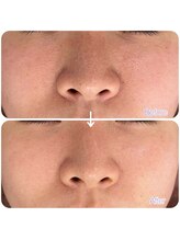 スリリアン 銀座/★お客さまビフォーアフター★