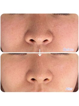 スリリアン 銀座/★お客さまビフォーアフター★