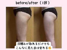 ヨサパーク ベアトリーチェ(YOSA PARK beatrice)/極上プレミアムコース一回