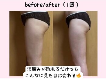 ヨサパーク ベアトリーチェ(YOSA PARK beatrice)/極上プレミアムコース一回