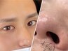 【男性】メンズアイブロウスタイリング＋ノーズワックス