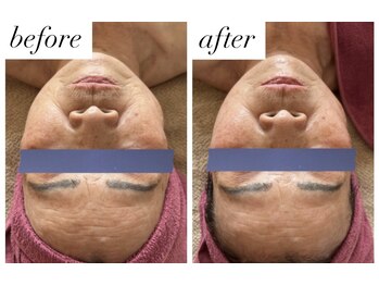 ベルシア(Bellucia)/