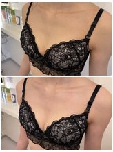 ルフルリール(Refleurir)/◆バストアップ症例/育乳◆