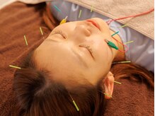 Anela鍼灸整体院