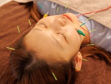 アネラ鍼灸整体院(Anela鍼灸整体院)