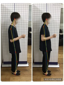 ボディメイク整体院 横浜駅西口店(BodyMake)/施術風景-背中の痛み改善希望-