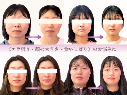 ハル(haru.)の写真