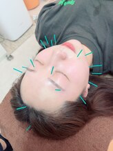 ヒーリングサロン アージュ(A-je)/★美顔鍼＋小顔矯正★