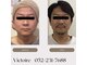 ヴィクトワール(Victoire)の写真