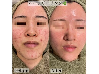 エステティックサロンRの写真