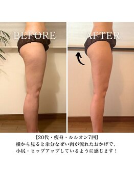 ヨサパーク フェリシア 西荻窪(YOSA PARK Felicia)/効果をしっかり感じられる!