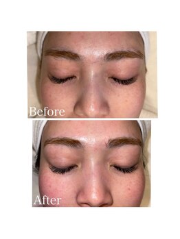 en.の写真/フェイスワックスで産毛や毛穴の汚れ、古い角質を取り除き、くすみのない透明感のあるお肌へ。