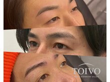 トイヴォ(TOIVO)