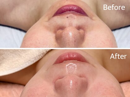 オルオル 天神大名店(Olu-.olu.)の写真