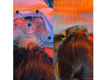 爽健美の雰囲気（溜まった老廃物を一掃！吸い玉×身体の電気鍼で全身デトックス）