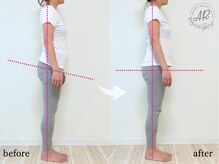 エーアール(AR)/【Before/After】　