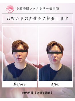 小顔美肌ファクトリー 梅田院/