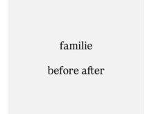 ファミリエ 大阪院(familie)/familie施術のbefore after