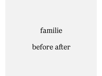 ファミリエ 大阪院(familie)/familie施術のbefore after