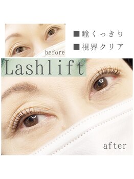 グレイス(grace)/