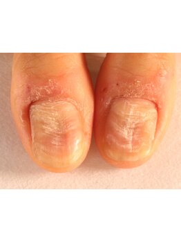 爪の悩みを解消できる（ケア含む）