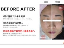 アヴェンタエイト(AVENTA8)の雰囲気（それぞれのお悩みに合わせた施術をご提案します♪）