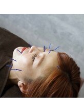 クラリ 春日井院(CLARI)/美容鍼ライトコース