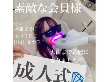 ライトビューティー 本八幡店(LIGHT BEAUTY)/【セルフホワイトニング】