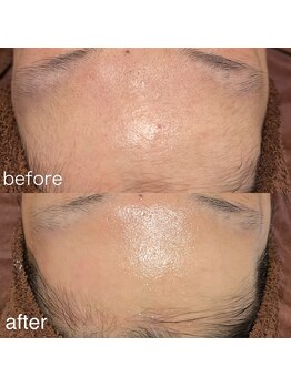 ソラ(sola*)/即日ウル艶美肌