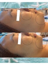 ポノ(Pono)/一度の施術効果☆