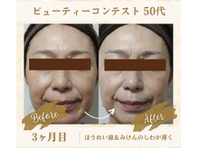 ソフィアパレス 西葛西店/ビューティーコンテストNo1