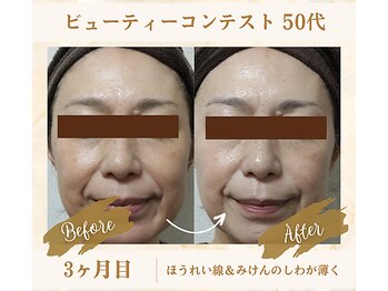 ソフィアパレス 西葛西店/ビューティーコンテストNo1