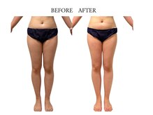 ヨサパーク サノン(YOSA PARK Sanon)/産後太り、諦めないで！！！