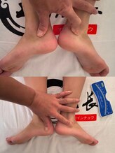 整体 王院長/骨盤矯正ビフォーアフター