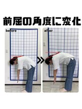 しんご鍼灸整骨院/整体ビフォーアフター