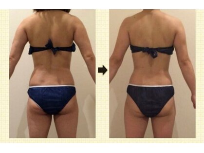 クリア(Clear)の写真