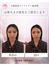 小顔美肌ファクトリー 梅田院/