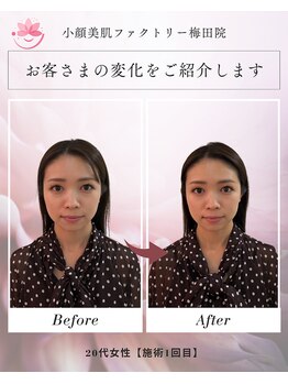 小顔美肌ファクトリー 梅田院/