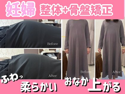 ラフィング(Laughing)の写真