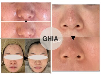 ギア ヘルス(GHIA health)の写真/【30代からの素肌の肌育】高機能美容ケア成分をチャージ！細胞レベルで素肌に自信を育てます♪
